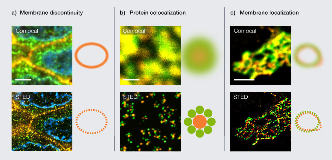 Application Snapshot "How much can I trust my antibody" Figure 1