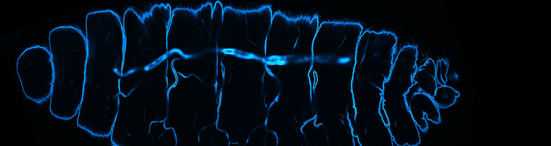 Drosophila stage 17 embryo stained for chitin