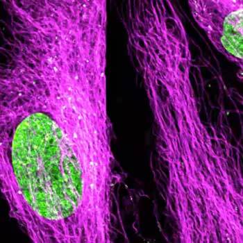 Cells with labeled cytoskeleton and mitochondria