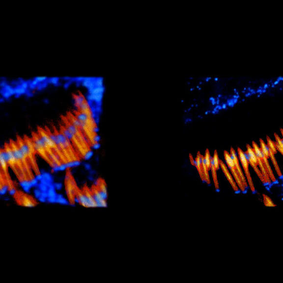 3D two-color animation of ofActin and Whirlin in mouse inner ear hair cells