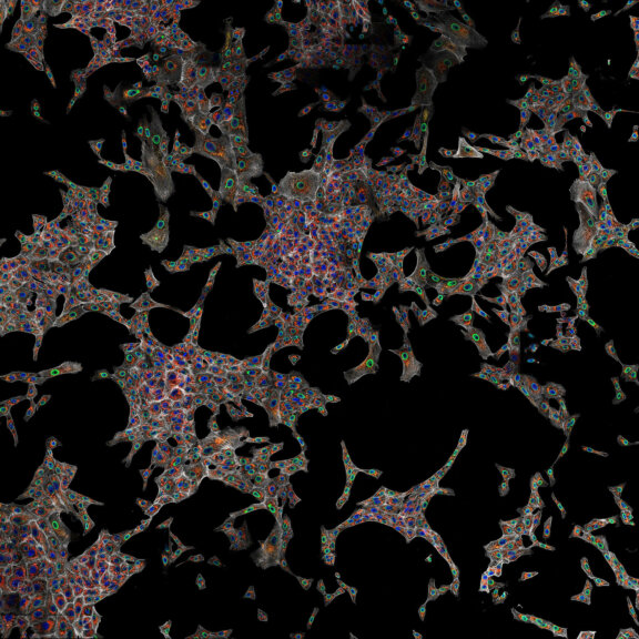 Four-color microscopic image stitched with SVI Huygens