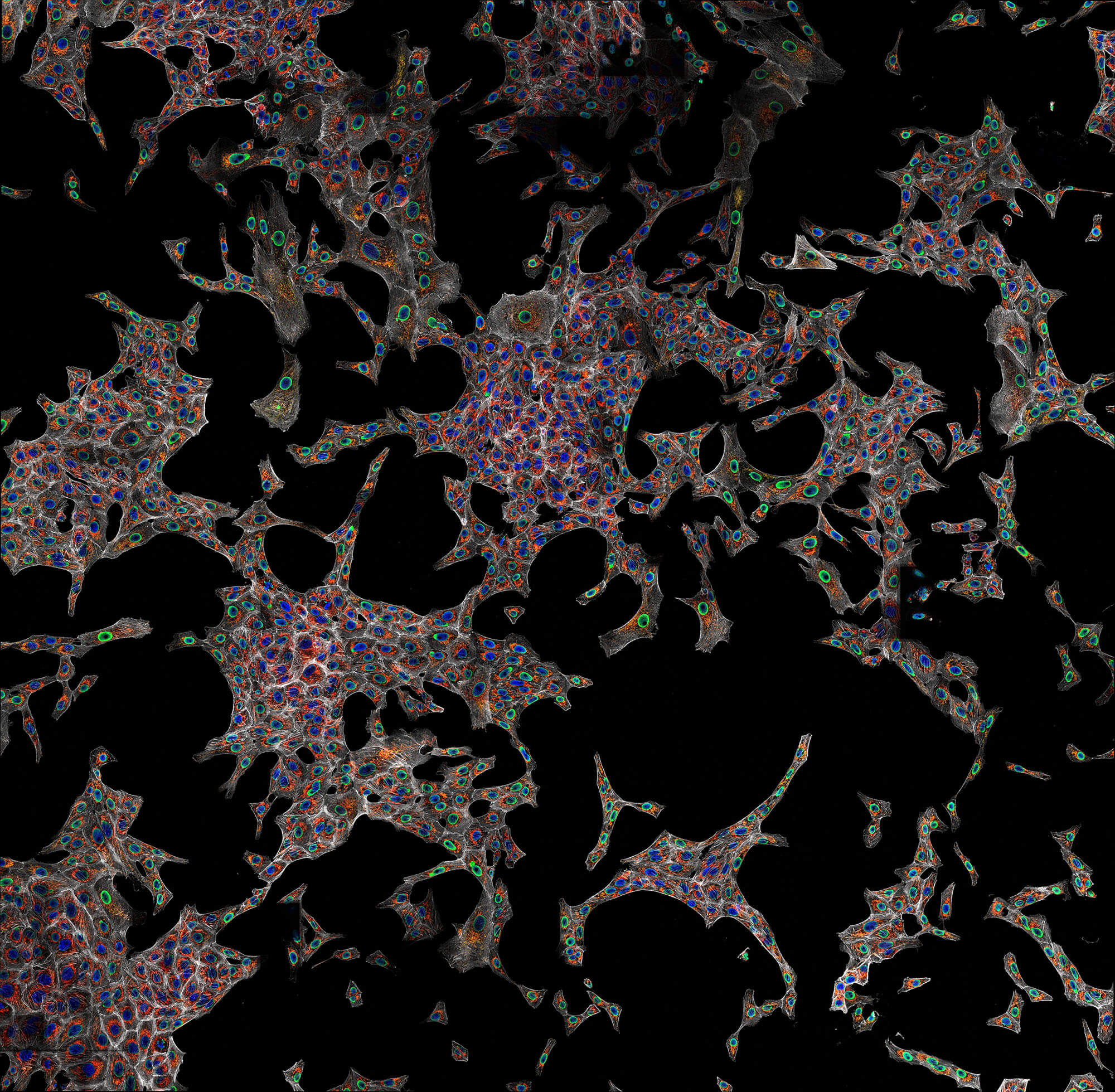 Four-color microscopic image stitched with SVI Huygens