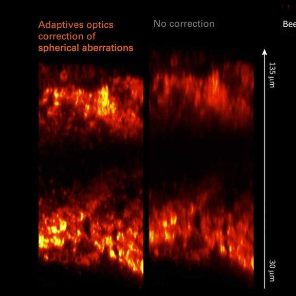 Comparison of spherical aberration correction using adaptive optics