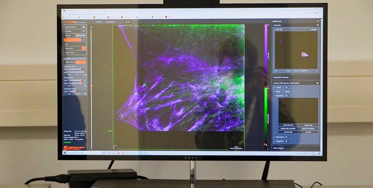 Impressions from abberior's course at EMBL from 19/09 to 24/09/2022: live-cell imaging with STEDYCON, 2-color STED