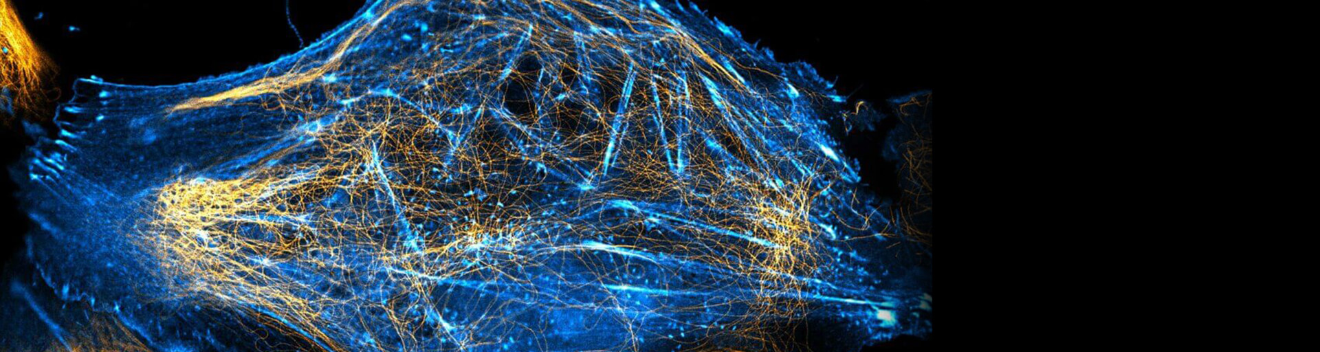 2-color STED image of a living cell labeled with abberior dyes, LIVE 610 tubulin and LIVE 550