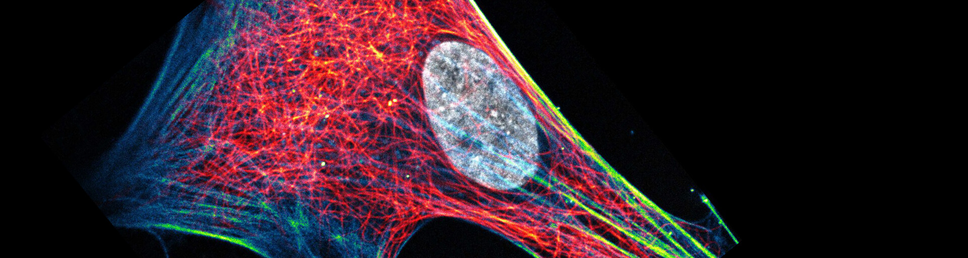 Composite of three color live-cell image of an adherent mammalian cell. This living cell was directly labelled with abberior LIVE 510 actin (blue/green), LIVE 560 DNA (gray) and LIVE 610 tubulin.