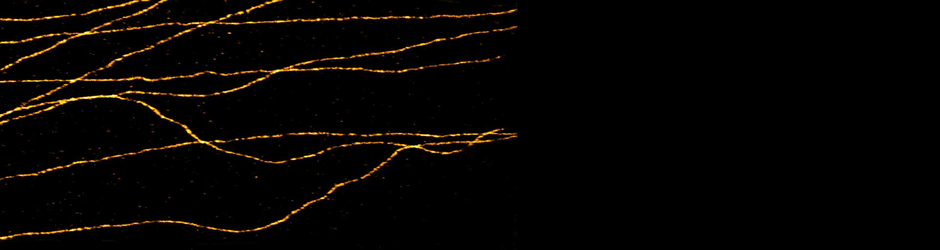 1-color STED image of ms tubulin, stained wit nanobody conjugated abberior STAR RED