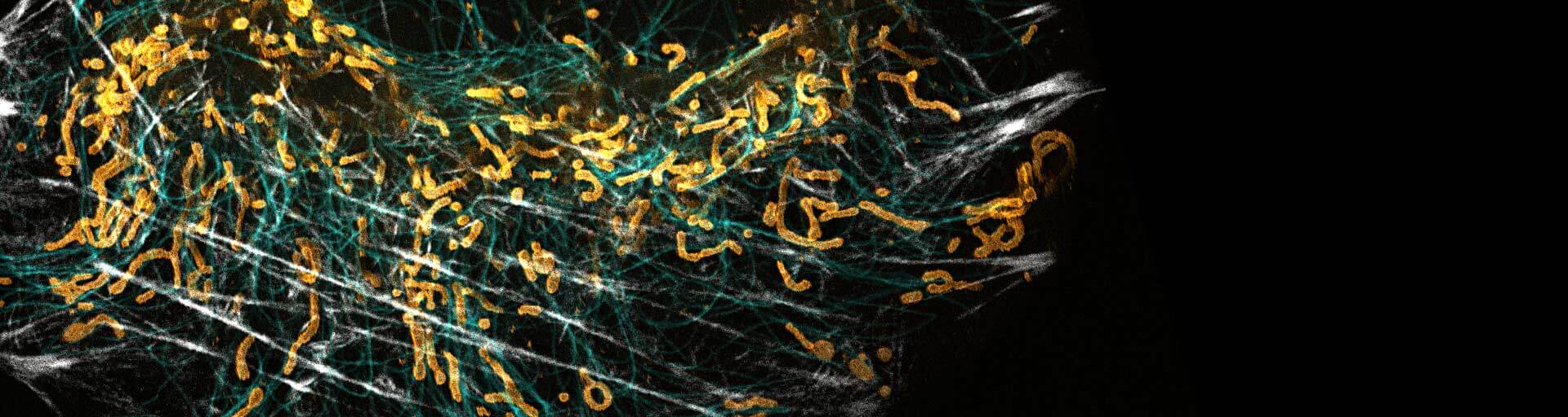 3-color live-cell STED with abberior LIVE HaloX licenced from spirochrome