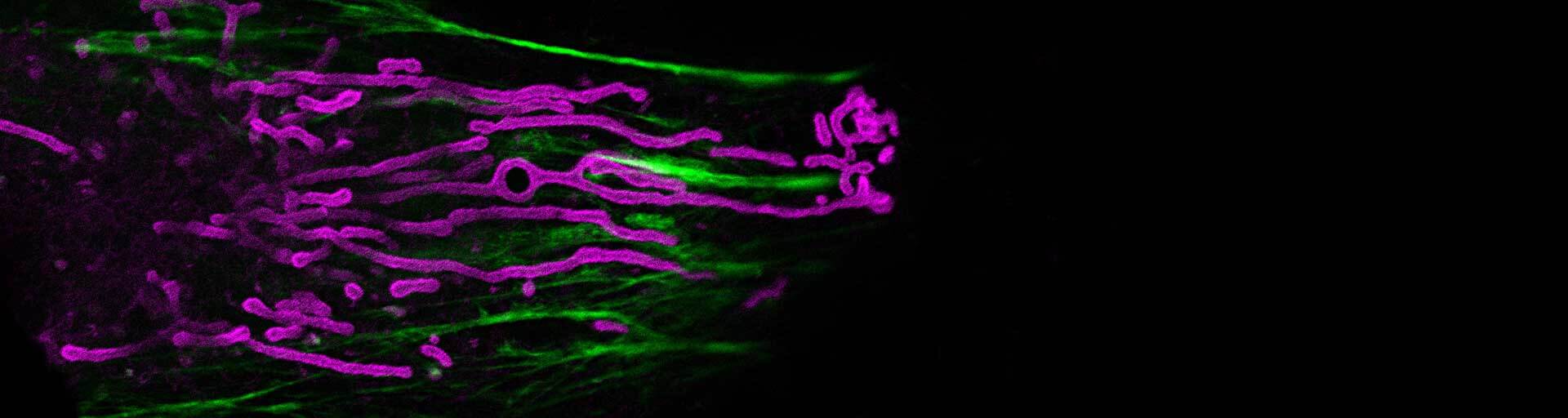 2-color live-cell STED with abberior LIVE HaloX, licenced from spirochrom