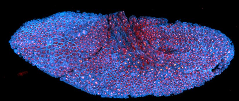 Drosophila stage 12 embryo stained for tubulin and DNA