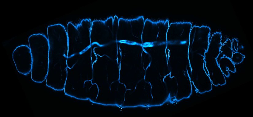 Drosophila stage 17 embryo stained for chitin