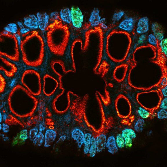 MATRIX STED image of a paraffin section of gut biopsy stained for Ki67 (abberior STAR ORANGE), Muc2 (abberior STAR RED), and DAPI. 