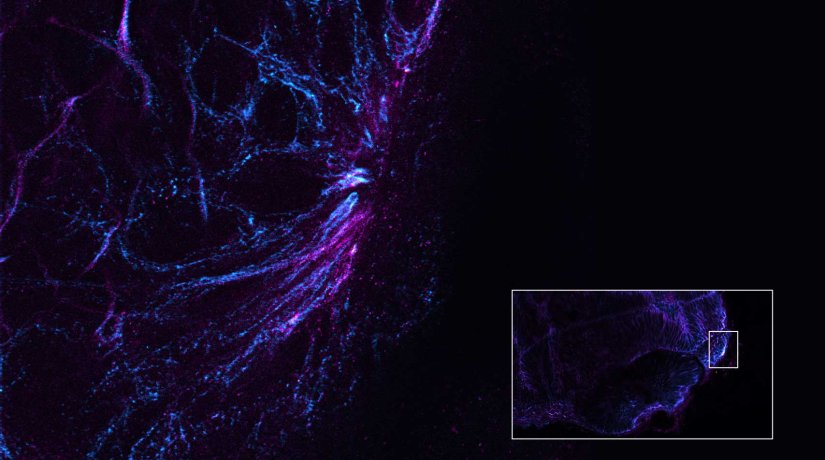 MATRIX Detector - @abberior.rocks