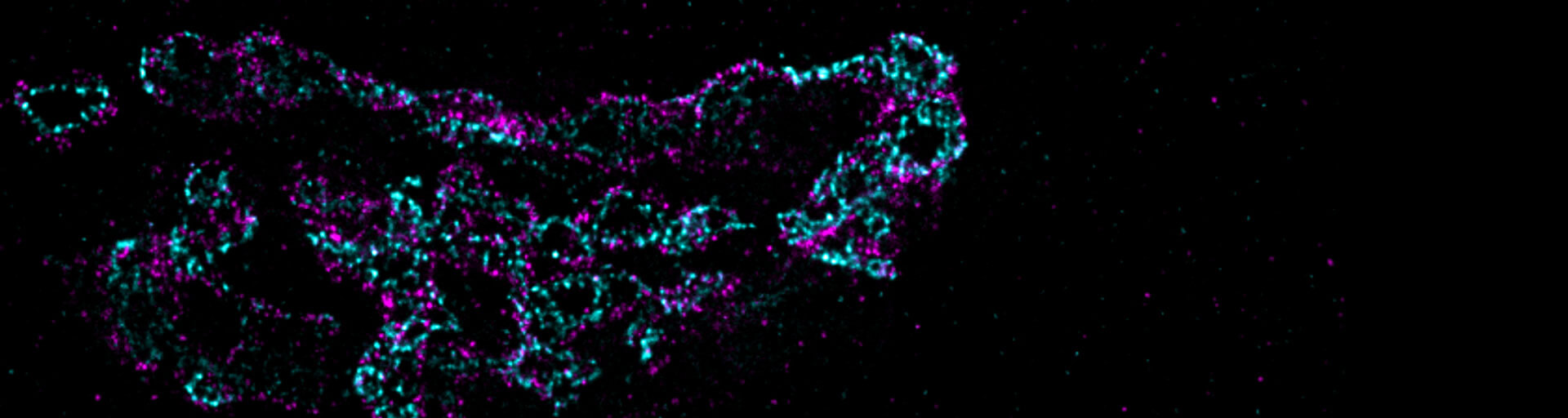 2-color image stained for Giantin and GM130