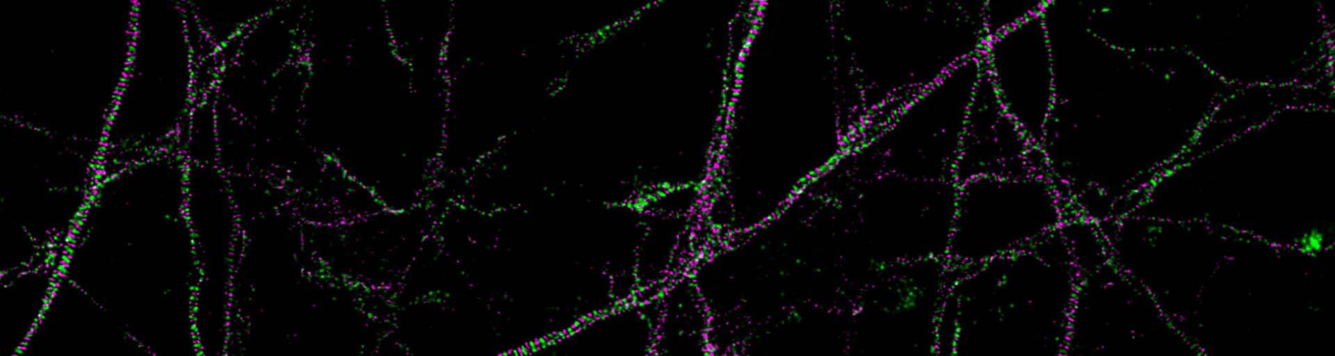 Two-color image of neurons imaged with STEDYCON