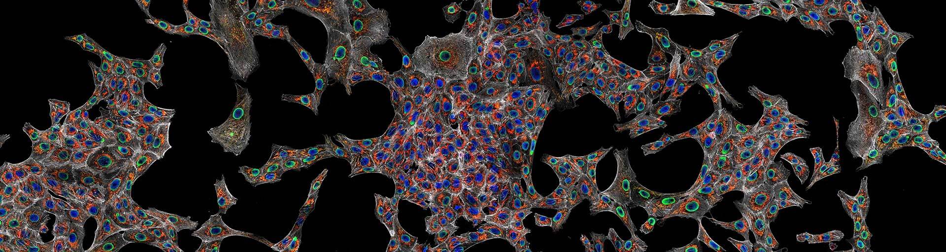 Stiched confocal image stained for TOM20 and DNA