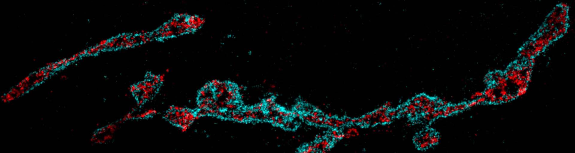 Two-color image of the Golgi apparatus imaged with STEDYCON