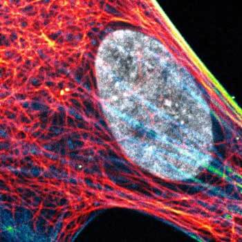 Composite of three color live-cell image of an adherent mammalian cell. This living cell was directly labelled with abberior LIVE 510 actin.