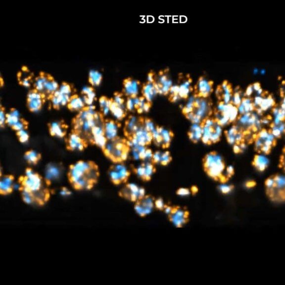 ExM herpes virus particles_comparison