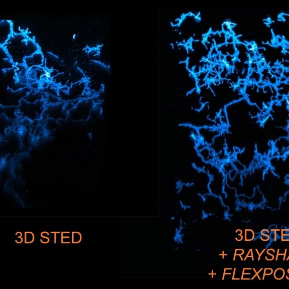 Microglia volume_STED_vs_STED+RAY+FLEX