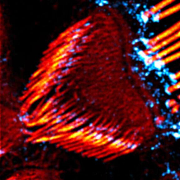 STED image of actin in mouse inner ear hair cells