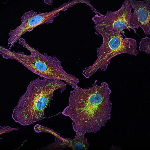 Four-color confocal image of DAPI, Actin, Tubulin and Tom20 in mammalian cells