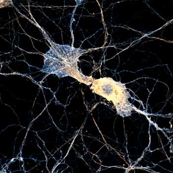 Neurons stained for spectrin and adducine