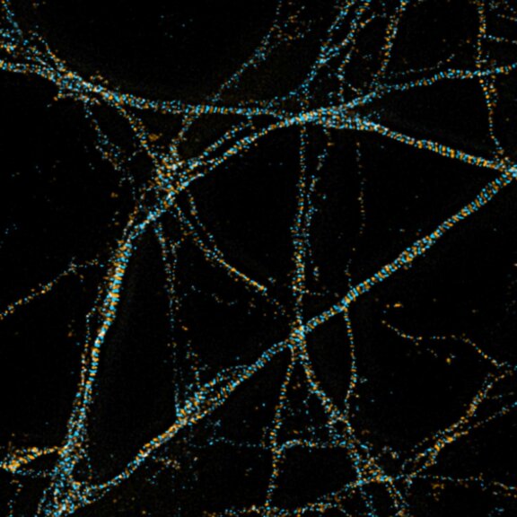 Two-color STED image of adducin and spectrin in the axons of neurons in super-resolution