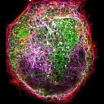 Three color live-cell STED with labeled ER, tubulin, and actin