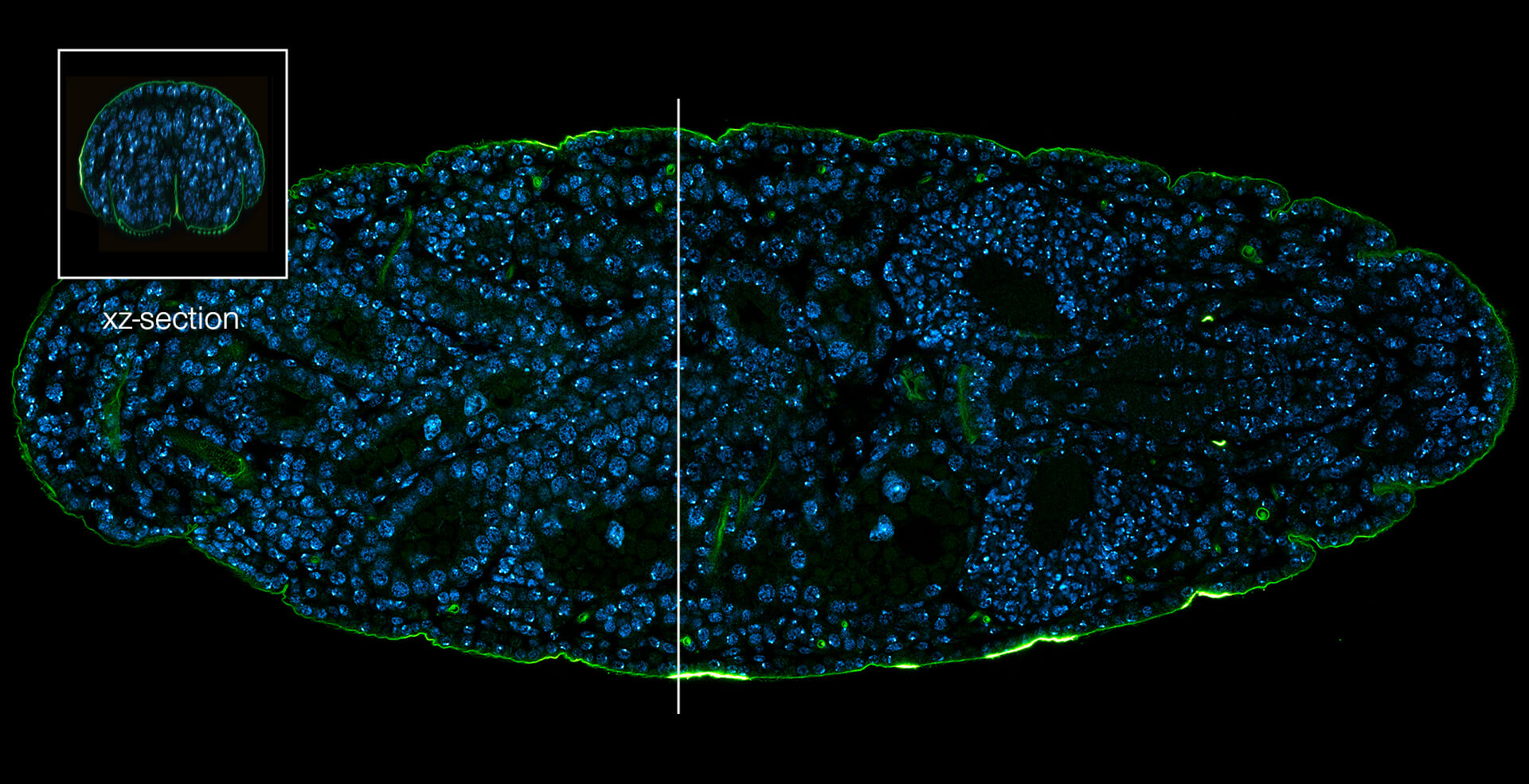 Comparison of RAYSHAPE deformable mirror vs correction collar objective lens. Stage 17 Drosophila embryo stained for chitin (abberior LIVE 610, green) and DNA (abberior LIVE 550, cyan). Overview