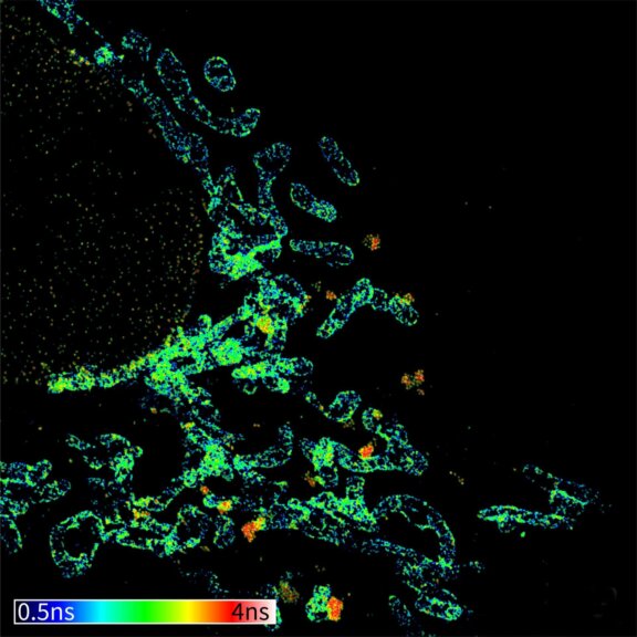 Background-free two-dye STED fluorescence lifetime image of Tom20 and nuclear pores