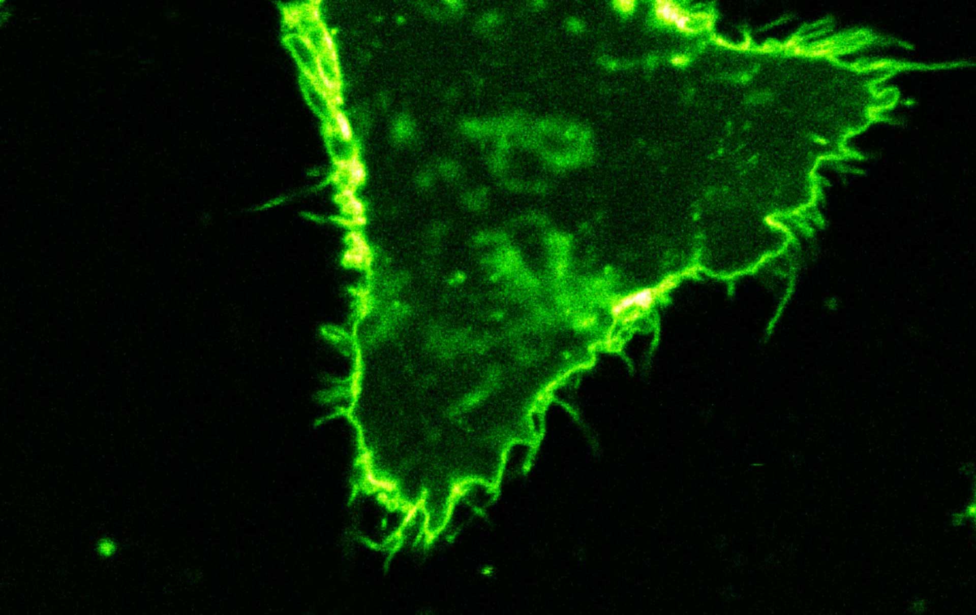 Two color live-cell STED and confocal image of a mammalian cultured cell stained with abberior STAR RED membrane (orange) and abberior LIVE 590 actin (cyan).