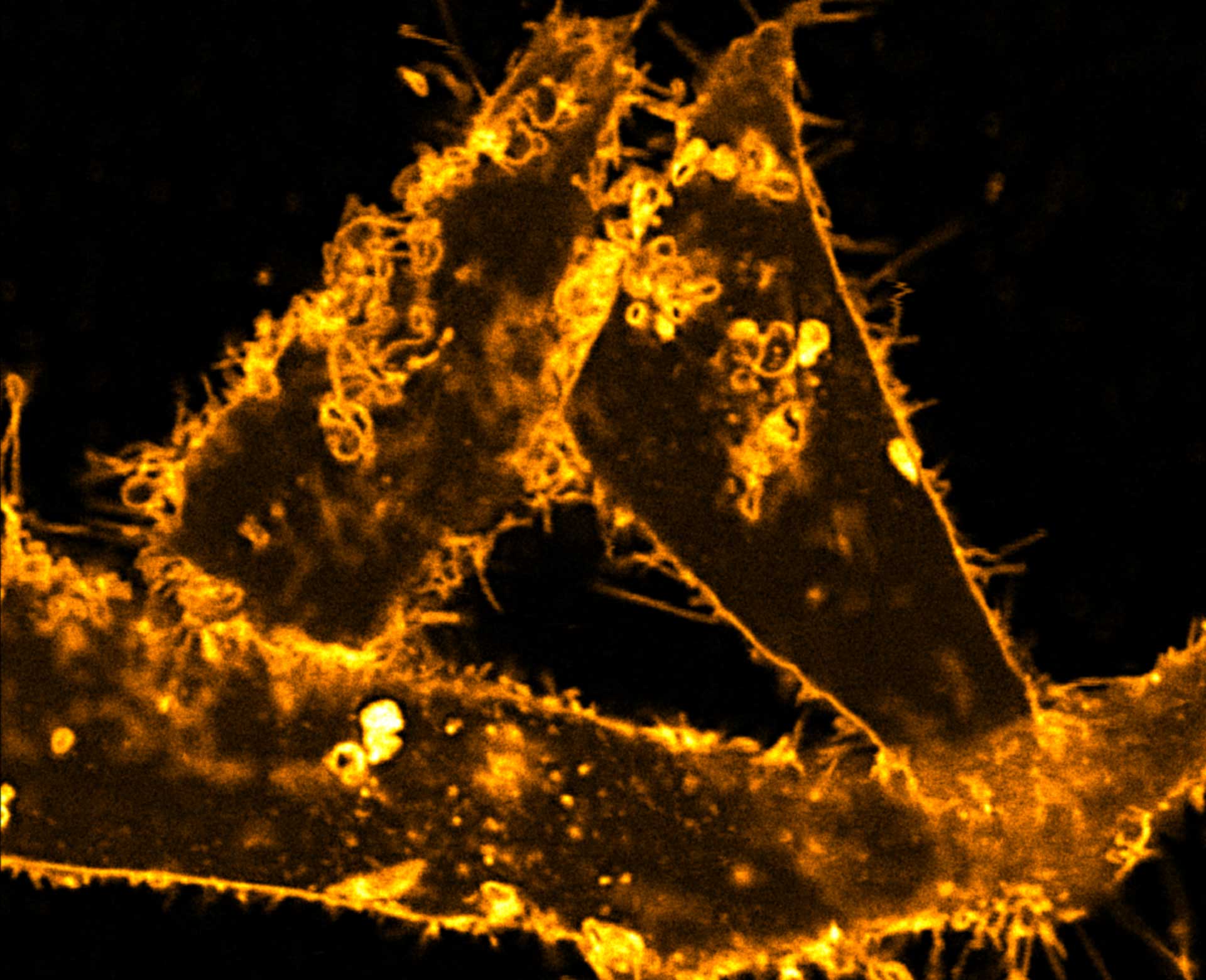 Comparison of STED and confocal of a living mammalian cell stained with abberior STAR ORANGE membrane.