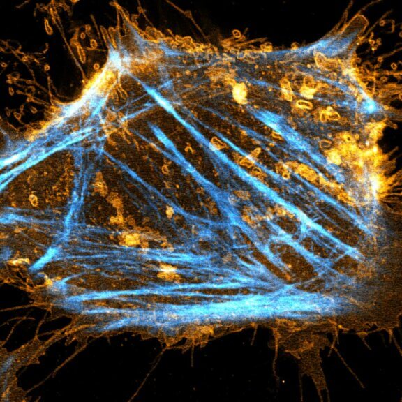 Mammalian cultured cell stained with abberior STAR RED membrane (orange) and abberior LIVE 590 actin (cyan), STED image