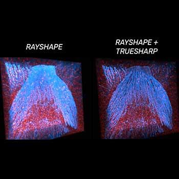 Volume of Drosophila larval CNS, stained for tubulin and DNA, imaged with RAYSHAPE aberration correction