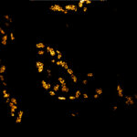STED image of the protein Bruchpilot in synapses of a neuromuscular junction in fruit fly larvae