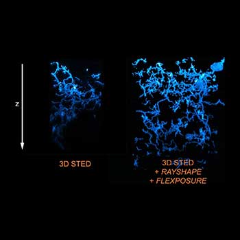 3D STED of microglia and processes labeled for a specific cell surface receptor in neocortical tissue of perfusion-fixed mouse.