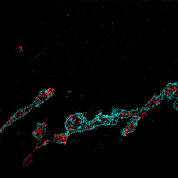 Two-color STED image of GM130 and Giantin in the Golgi apparatus in super-resolution