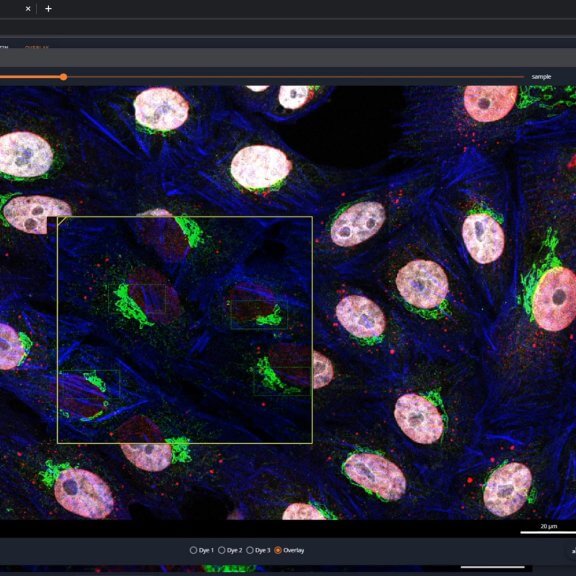 STEDYCON smart control software multipositioning