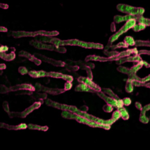 STED Image of mitochondria cristae in mammalian cell labeled with abberior LIVE ORANGE mito. STED image has been required on STEDYCON.