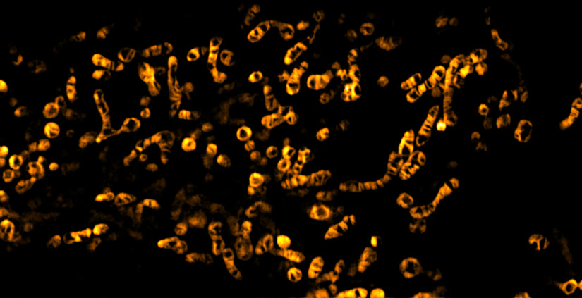 STED Image of mitochondria cristae in mammalian cell labeled with abberior LIVE ORANGE mito. STED image has been required on FACILITY.