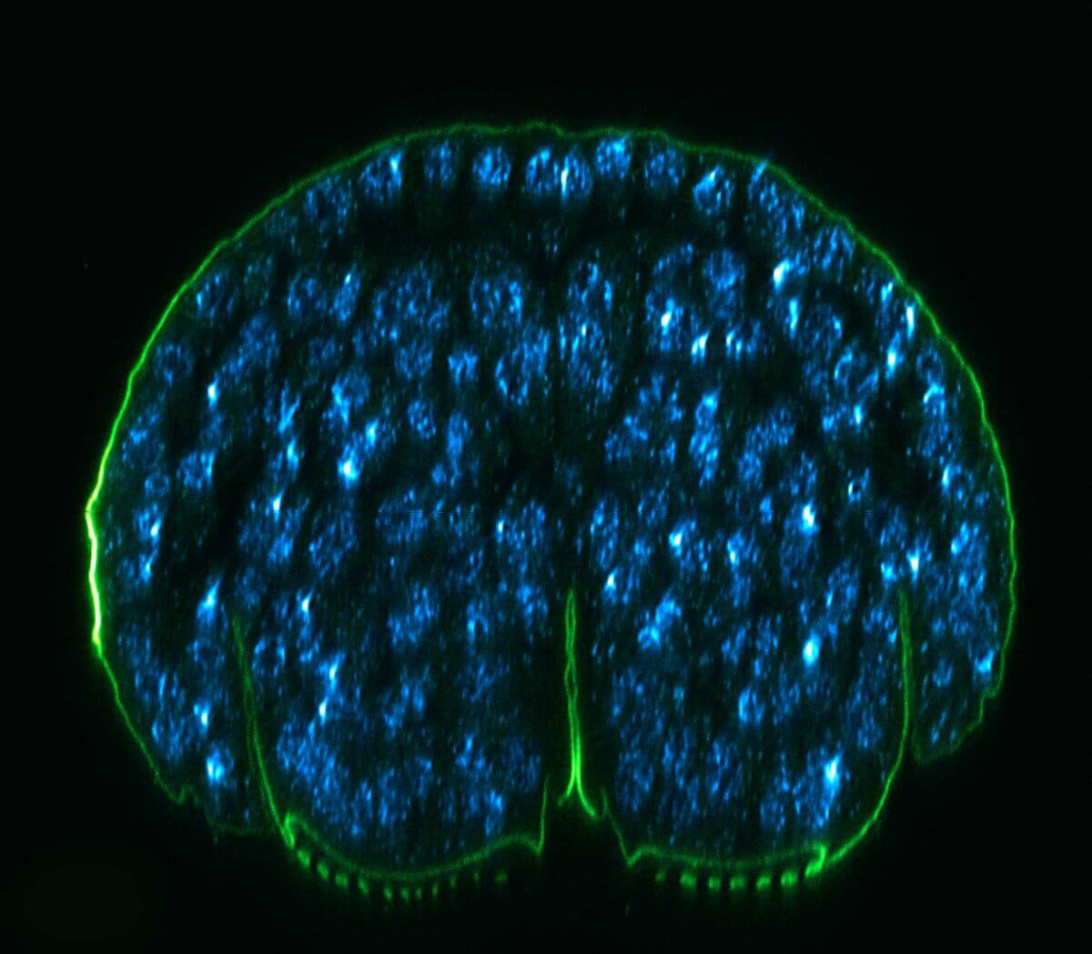 xz section of a stage 17 Drosophila embryo, stained for chitin and DNA