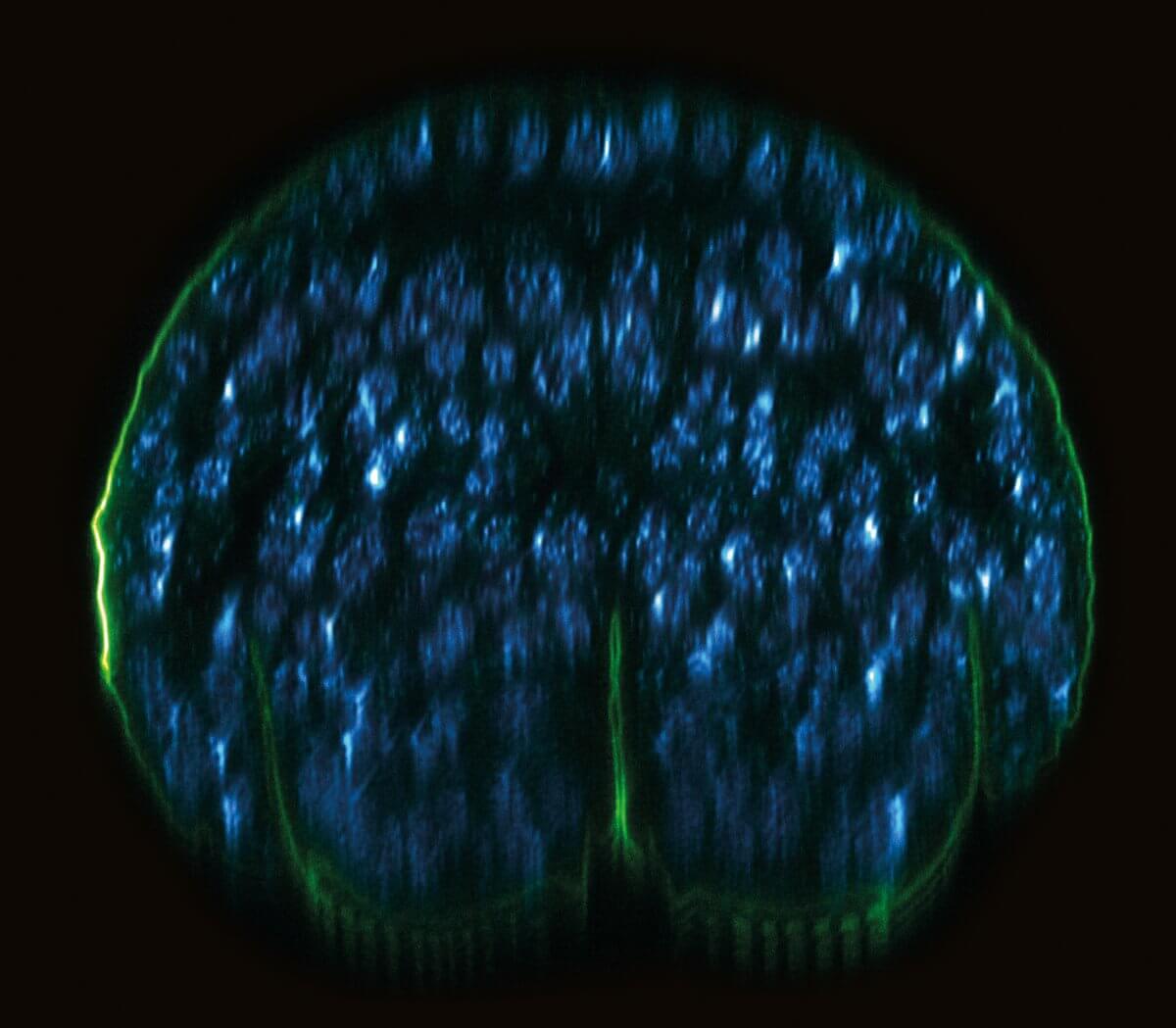 xz section of a stage 17 Drosophila embryo, stained for chitin and DNA with a correction collar set at the middle of the overall z-range