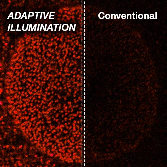 Thanks to adaptive illumination fluorophore bleaching is substantially reduced