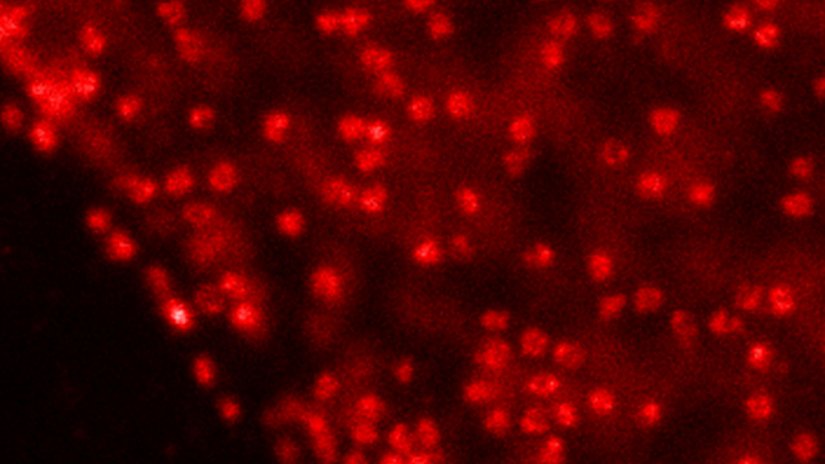 A confocal image compared to a MATRIX + TRUESHARP STED image of nuclear pore complexes in mammalian cells stained for NUP96 with abberior STAR RED.