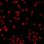 STED image of nuclear pore complexes in mammalian cells stained for NUP96 with abberior STAR RED. 