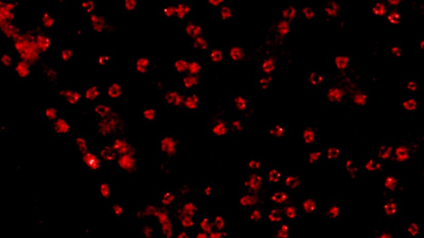 A confocal image compared to a MATRIX + TRUESHARP STED image of nuclear pore complexes in mammalian cells stained for NUP96 with abberior STAR RED.