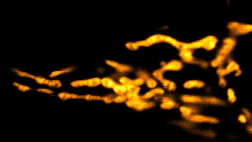 Living HeLa cells stained with the mitochondrial membrane marker abberior MITO ORANGE, visualizing both outer and inner membranes. Confocal and STED images where deconvolved with TRUESHARP image boosting.  