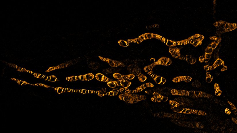 Living HeLa cells stained with the mitochondrial membrane marker abberior MITO ORANGE, visualizing both outer and inner membranes. Confocal and STED images where deconvolved with TRUESHARP image boosting.  