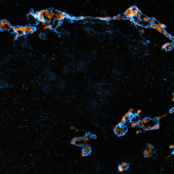 Fixed cells stained for the golgi proteins GM130 (cyan, abberior STAR RED) and giantin (orange, abberior STAR ORANGE). MATRIX+TRUESHARP image.